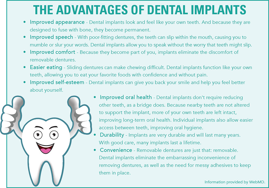 Advantages of Dental Implants