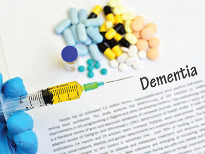 Alzheimer Research Dementia