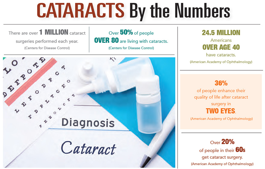 Cataracts by the Numbers
