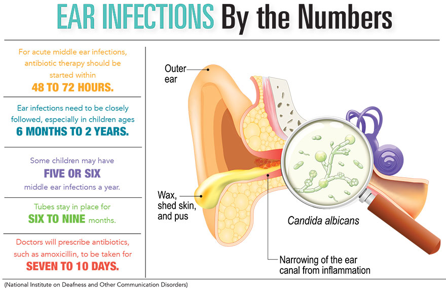 Ear Infections by the Numbers