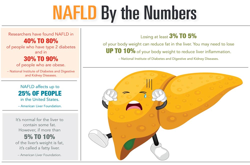 INFOGRAPHIC: NAFLD by the Numbers