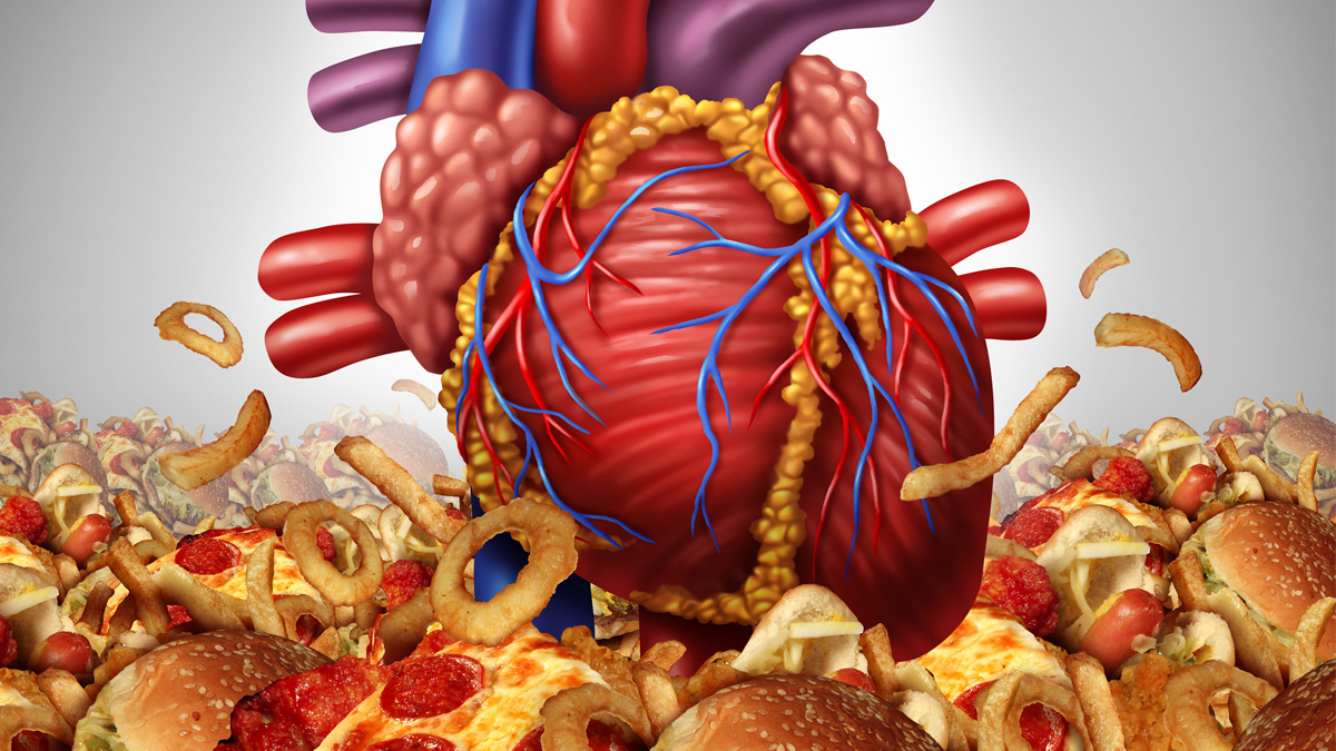Graphic of Heart Disease