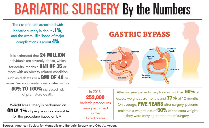 Bariatric Surgery by the Numbers