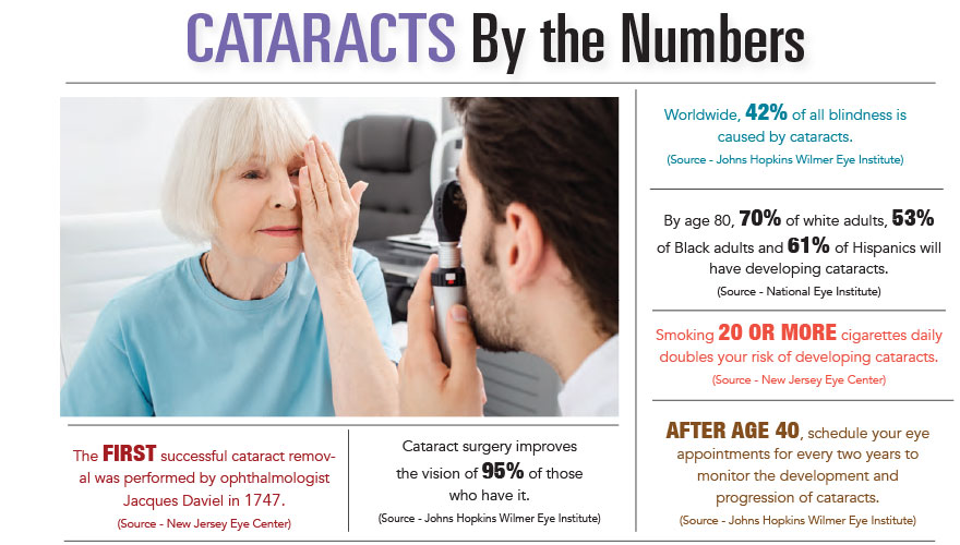 Cataracts by the Numbers