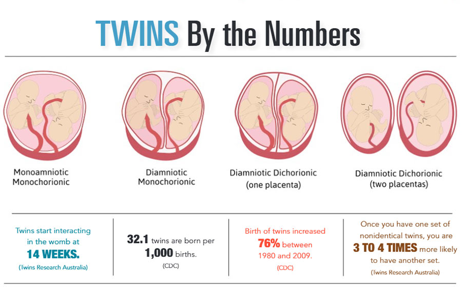 INFOGRAPHIC: Twins by the Numbers