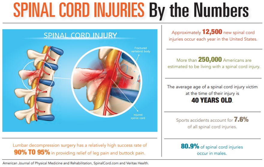 Spinal Cord Injuries by the Numbers